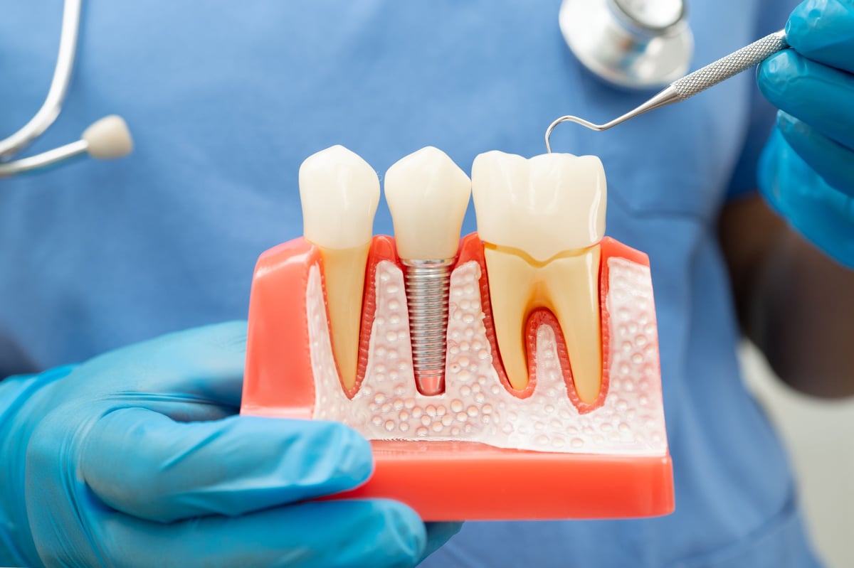 Dentista con instrumento dental
